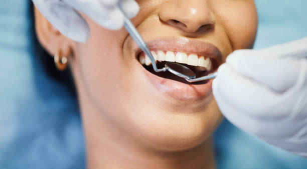 Best Same-Day Emergency Dental Services in New Hope, AL